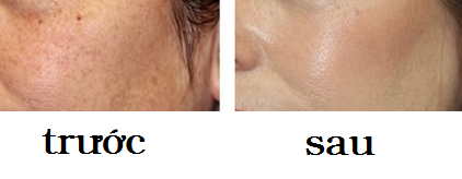 Dr Spiller Whitening De Pigmentor Serum có thể được dùng cho da mặt và nhiều vùng khác trên cơ thể.